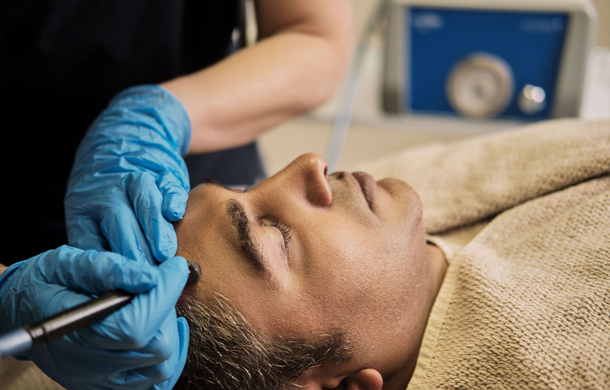 Men-Microdermabrasion