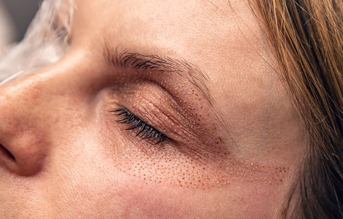 Plasmatek--Plasma-Pen-2